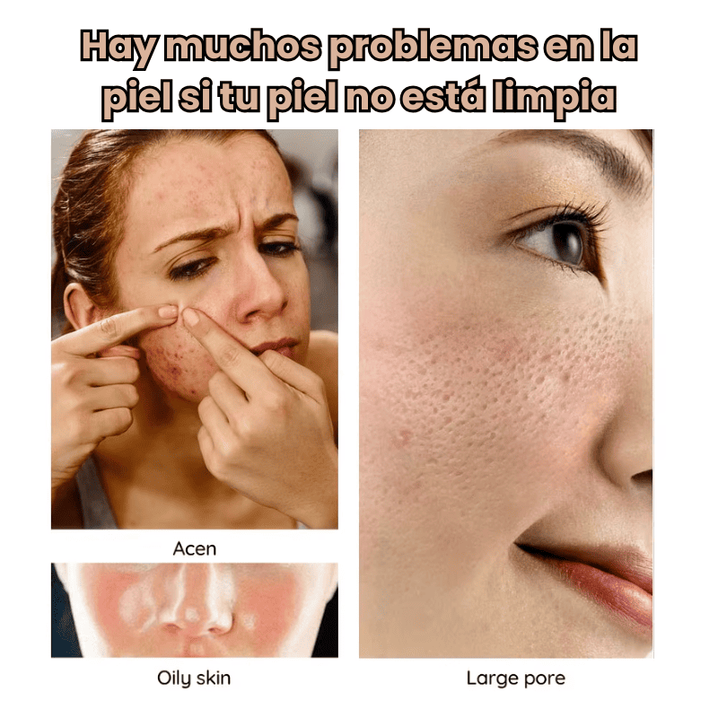 Dispositivo Facial Masajeador 4 en 1, Radiofrecuencia