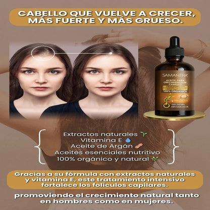 Samantha – Aceite para Crecimiento de Cabello - (COMPRA 1 Y LLEVA 2)