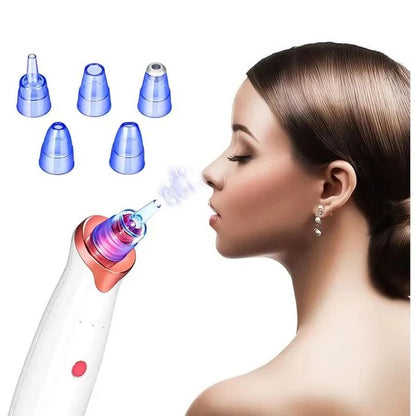 Extractor de Puntos Negros y Espinillas - LLEVA DE REGALO MASCARILLAS FACIALES🎁