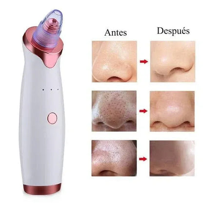 Extractor de Puntos Negros y Espinillas - LLEVA DE REGALO MASCARILLAS FACIALES🎁